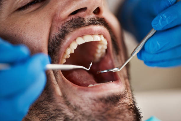 Best Laser Dentistry  in Herculaneum, MO